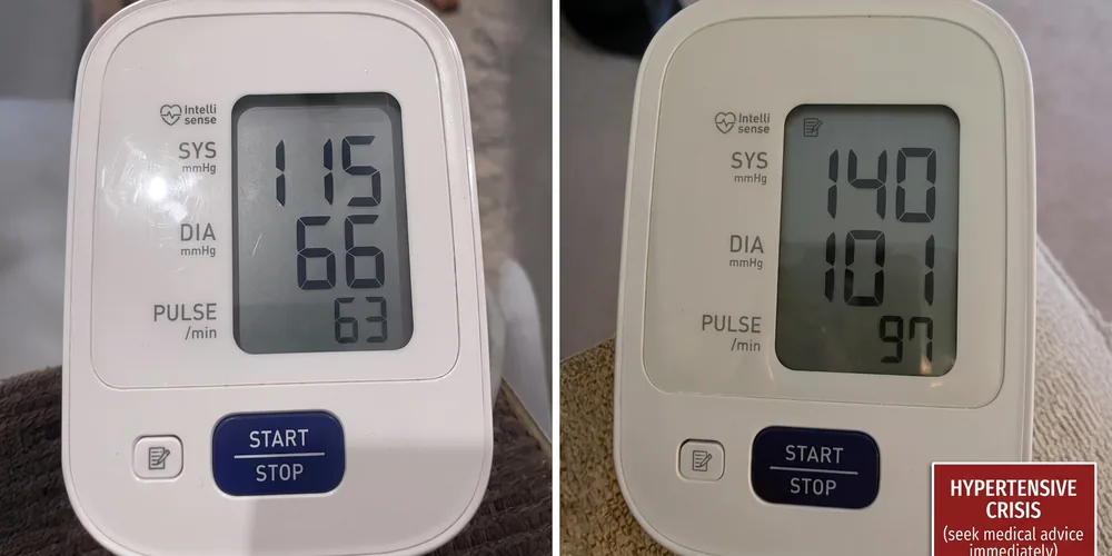 Blood pressure readings before and after
